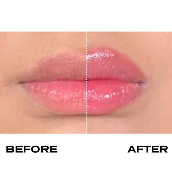 Plump It! No Needles Lip Filler Kit Original