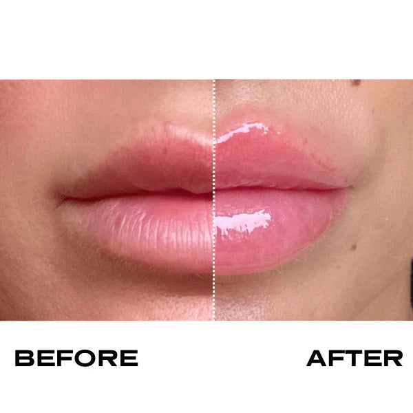 Plump It! No Needles Lip Filler Kit Original
