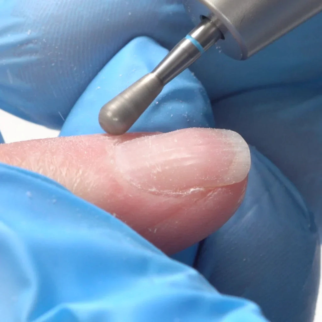 Bit gouttelette moyen d'Erica (1)