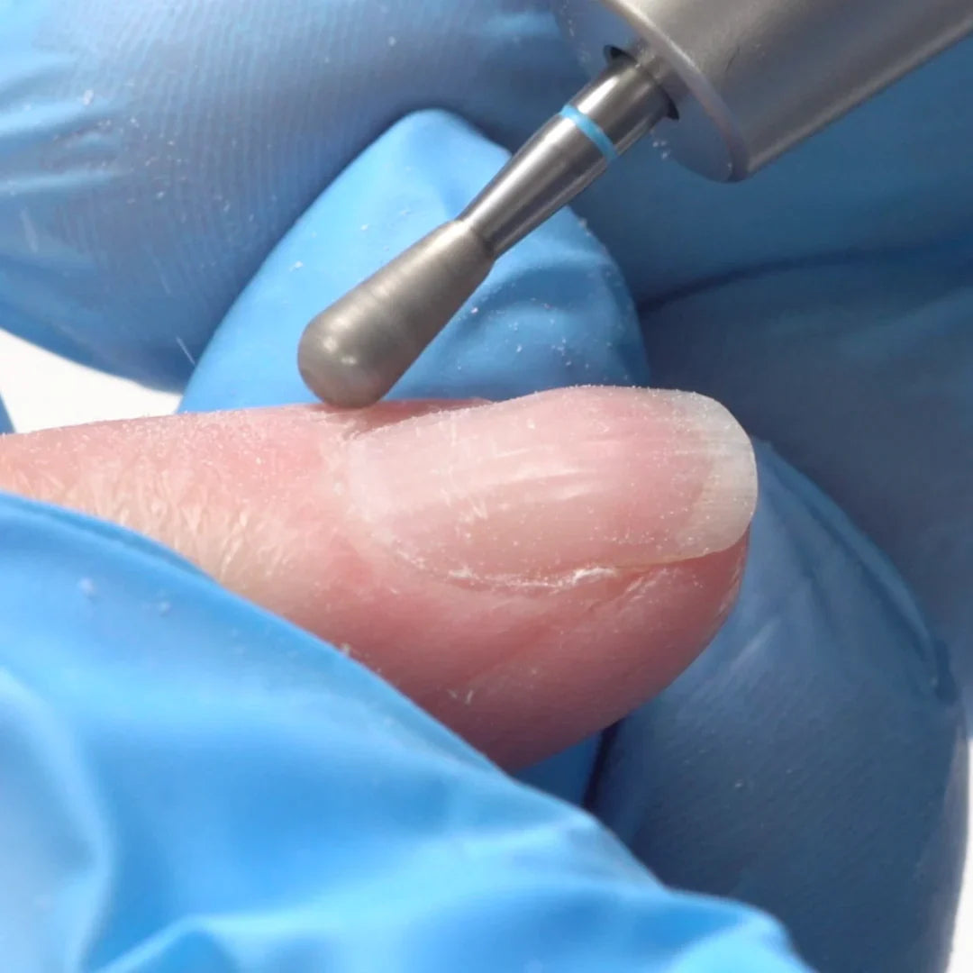 Bit gouttelette moyen d'Erica (1)