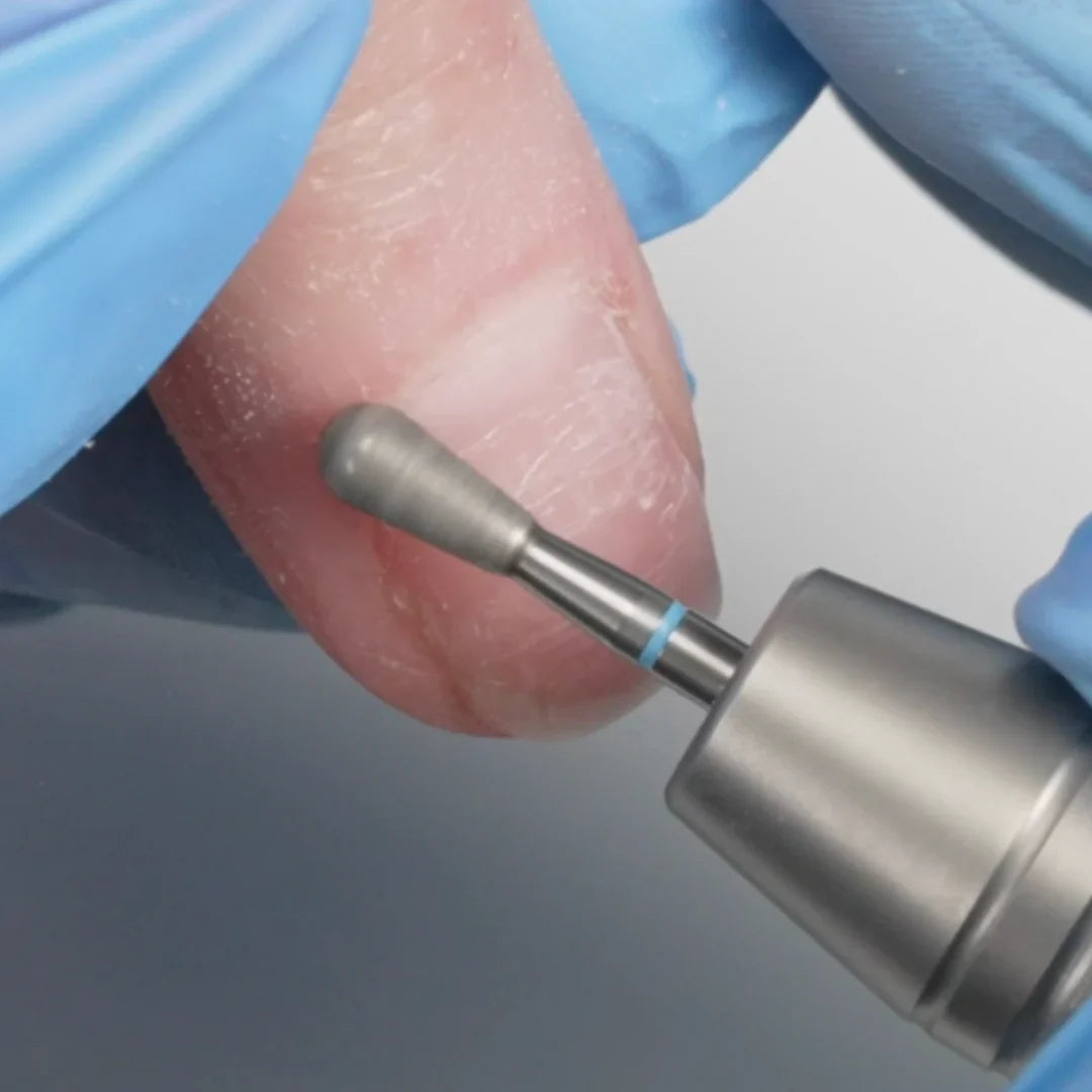 Bit gouttelette moyen d'Erica (1)