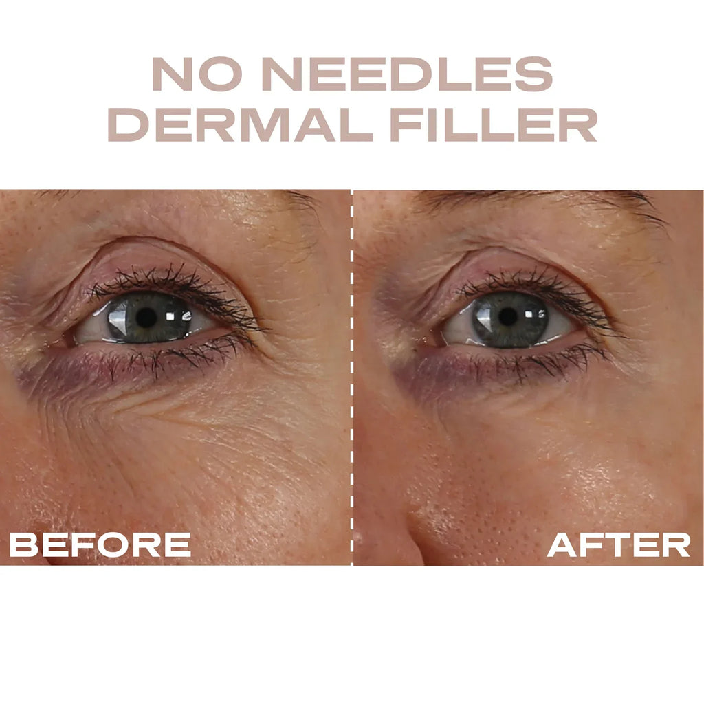 Plump It! No Needles Dermal Filler (30 applications)
