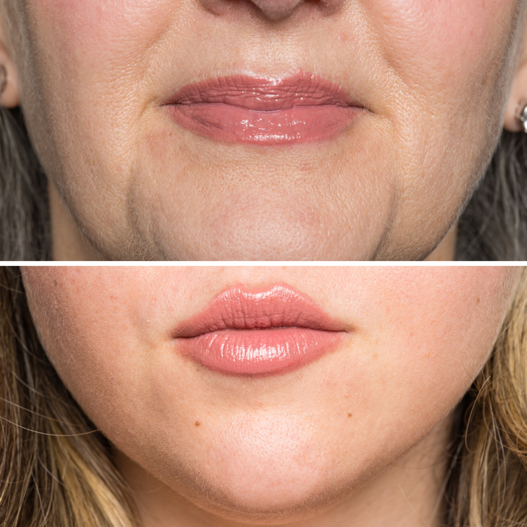 Harmony Lip Gloss