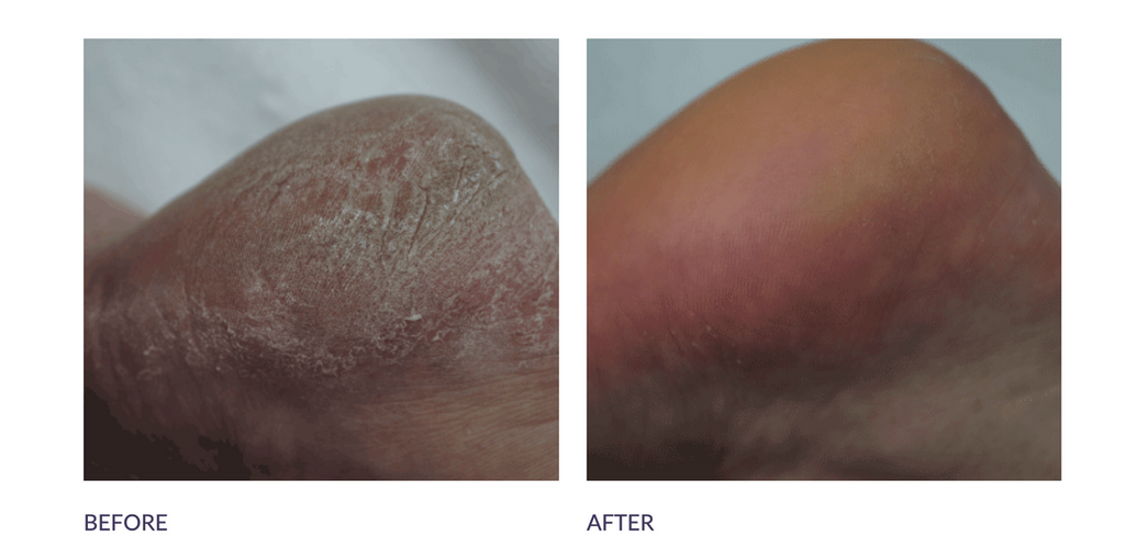 Footlogix DD Cream Mousse