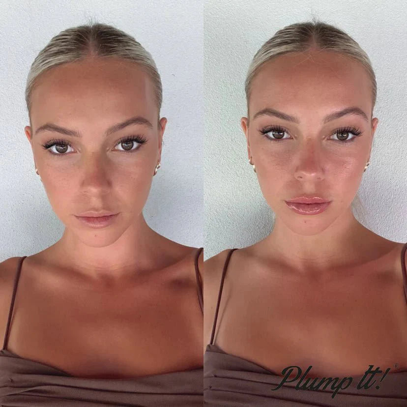 Repulpez votre peau ! Injections de comblement dermique sans aiguilles (30 applications)